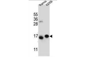EIF5AL1 Antibody (C-term) western blot analysis in Ramos,A2058 cell line lysates (35µg/lane). (EIF5AL1 antibody  (C-Term))
