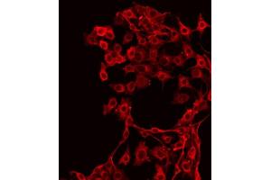 ABIN6267342 staining NIH-3T3 by IF/ICC. (c-MET antibody  (pTyr1349))