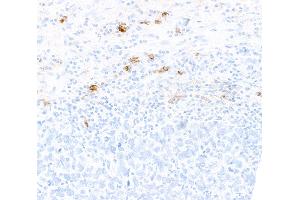 Immunohistochemistry (IHC) image for anti-CD80 (CD80) (AA 35-246) antibody (ABIN7449415)