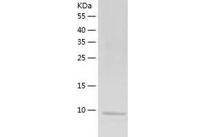 Western Blotting (WB) image for Chemokine (C-C Motif) Ligand 8 (CCL8) (AA 24-97) protein (His tag) (ABIN7122315) (CCL8 Protein (AA 24-97) (His tag))