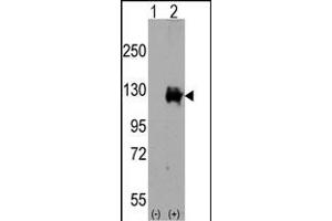 Western blot analysis of TR (arrow) using rabbit polyclonal TR Antibody (C-term) (ABIN392819 and ABIN2842251).