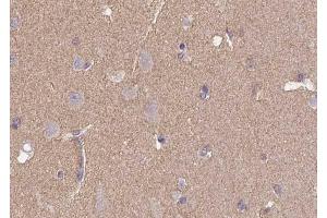 Immunohistochemistry analysis of CD57 antibody in paraffin-embedded human brain tissue. (CD57 antibody  (N-Term))