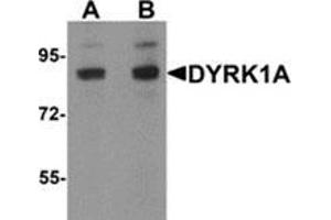 Western blot analysis of DYRK1A in HeLa cell lysate with DYRK1A antibody at (A) 1 and (B) 2 μg/ml. (DYRK1A antibody  (C-Term))
