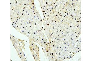 IHC analysis of PTBP2 using anti-PTBP2 antibody (ABIN7599452). (PTBP2 antibody  (AA 1-504))