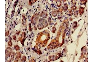 Immunohistochemistry of paraffin-embedded human salivary gland tissue using ABIN7152346 at dilution of 1:100 (SULF2 antibody  (AA 463-660))