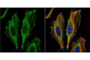 ICC/IF Image Aspartoacylase antibody [N1C3-2] detects Aspartoacylase protein at cytoplasm by immunofluorescent analysis. (ASPA antibody)