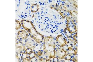 Immunohistochemistry of paraffin-embedded mouse kidney using COMT antibody (ABIN5973647) at dilution of 1/100 (40x lens). (COMT antibody)