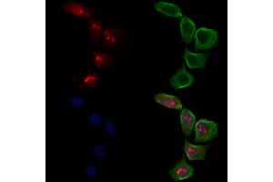 ABIN6263619 and ABIN6278595 staining Hela cells by IF/ICC. (Neurofibromin 1 antibody)
