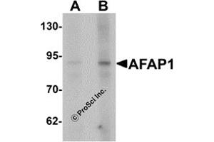 Western Blotting (WB) image for anti-Actin Filament Associated Protein 1 (AFAP1) (N-Term) antibody (ABIN1031217) (AFAP antibody  (N-Term))