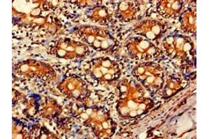 Immunohistochemistry of paraffin-embedded human small intestine tissue using ABIN7143442 at dilution of 1:100 (ARF1 antibody  (AA 2-181))