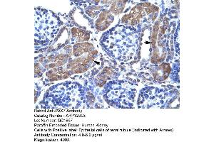 Rabbit Anti-PAX7 Antibody  Paraffin Embedded Tissue: Human Kidney Cellular Data: Epithelial cells of renal tubule Antibody Concentration: 4. (PAX7 antibody  (N-Term))