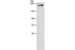 Western Blot analysis of Mouse lung tissue using IQGAP3 Polyclonal Antibody at dilution of 1:850 (IQGAP3 antibody)