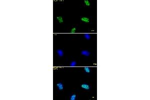 Immunofluorescence stain of Histone H3K9ac antibody (pAb). (Histone 3 antibody  (acLys9))