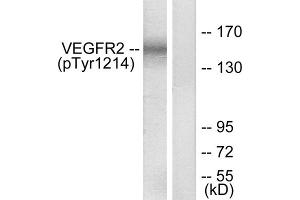 Western blot analysis of extracts from HepG2 cells, treated with Na3VO4 (0. (VEGFR2/CD309 antibody  (pTyr1214))