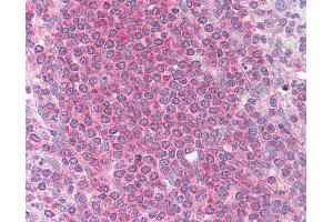 Anti-MCL1 antibody IHC of human spleen. (MCL-1 antibody)