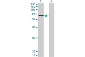Western Blot analysis of CACNB1 expression in transfected 293T cell line by CACNB1 monoclonal antibody (M01), clone 1G6. (CACNB1 antibody  (AA 500-598))