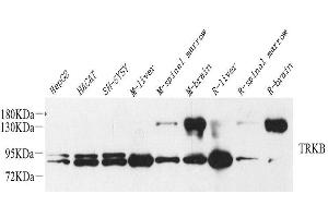 Western Blot analysis of various samples using NTRK2 Polyclonal Antibody at dilution of 1:1000. (TRKB antibody)