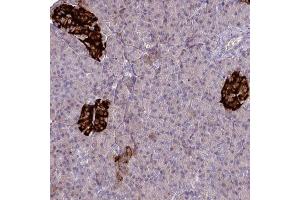 Immunohistochemical staining (Formalin-fixed paraffin-embedded sections) of human pancreas with SLAMF6 polyclonal antibody  shows strong cytoplasmic positivity in islets of Langerhans. (SLAMF6 antibody  (AA 40-115))