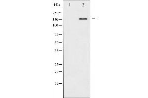 Western blot analysis of ASK1 expression in MDA-MB-435 whole cell lysates,The lane on the left is treated with the antigen-specific peptide. (ASK1 antibody  (N-Term))