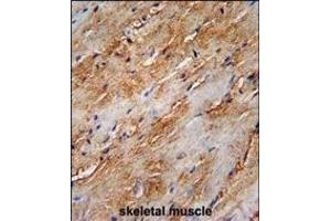 G8b (M1LC3B)-T93/Y99 Antibody (Center) 1802e immunohistochemistry analysis in forlin fixed and paraffin embedded hun skeletal muscle followed by peroxidase conjugation of the secondary antibody and DAB staining. (APG8b (AA 74-106) antibody)