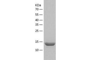 Western Blotting (WB) image for Calcium Regulated Heat Stable Protein 1, 24kDa (CARHSP1) (AA 1-147) protein (His tag) (ABIN7289471) (CARHSP1 Protein (AA 1-147) (His tag))