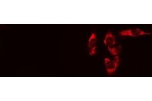 ABIN6275097 staining HeLa cells by IF/ICC. (RNF144B antibody  (Internal Region))