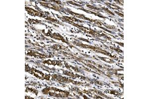 IHC analysis of MitoNEET/CISD1 using anti-MitoNEET/CISD1 antibody (ABIN7601089). (CISD1 antibody  (AA 28-93))