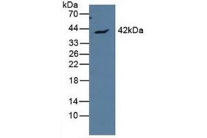 Detection of APOL1 in Human MCF7 Cells using Polyclonal Antibody to Apolipoprotein L (APOL1) (APOL1 antibody  (AA 1-238))