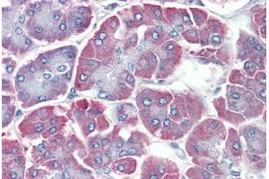 Human Pancreas: Formalin-Fixed, Paraffin-Embedded (FFPE) (BACE2 antibody  (C-Term))