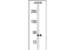 Western blot analysis in Jurkat cell line lysates (35ug/lane). (ZNF337 antibody  (C-Term))