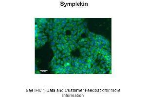 Sample Type :  Human HT29 cells  Primary Antibody Dilution :  1:50  Secondary Antibody :  Donkey anti Rabbit-Alexa Fluor 488  Secondary Antibody Dilution :  1:500  Color/Signal Descriptions :  Green: Symplekin Blue: DAPI  Gene Name :  SYMPK  Submitted by :  Louise Lagerqvist (PhD), Oncology Department, Institute of Functional Genomics, Montpellier, France. (Symplekin antibody  (N-Term))