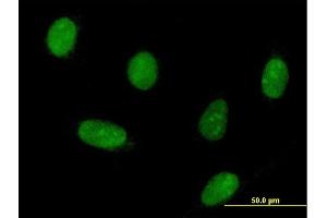 Immunofluorescence of purified MaxPab antibody to HNRPK on HeLa cell.