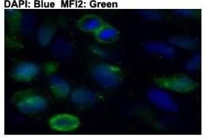 Immunofluorescent staining of HeLa cells with MFI2 polyclonal antibody  at 1:50 dilution. (MFI2 antibody  (C-Term))