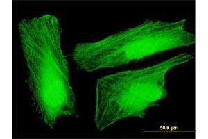 Immunofluorescence of purified MaxPab antibody to UXT on HeLa cell. (UXT antibody  (AA 1-169))
