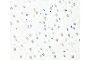 Immunohistochemistry of paraffin-embedded Mouse brain using CHRAC1 Polyclonal Antibody at dilution of 1:100 (40x lens). (CHRAC1 antibody)