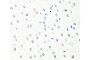 Immunohistochemistry of paraffin-embedded Mouse brain using CHRAC1 Polyclonal Antibody at dilution of 1:100 (40x lens).