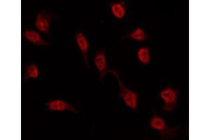 ABIN6274552 staining Hela by IF/ICC. (ASF1A antibody  (Internal Region))