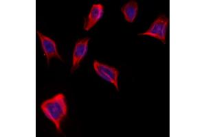 ABIN6262005 and ABIN6273249 staining Hela by IF/ICC.