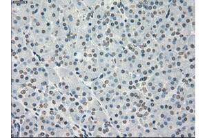 Immunohistochemical staining of paraffin-embedded colon tissue using anti-PPP5Cmouse monoclonal antibody. (PP5 antibody)
