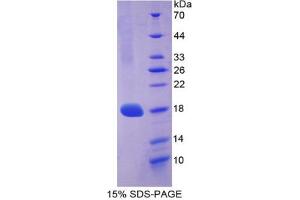 SDS-PAGE analysis of Mouse COL3A1 Protein. (COL3A1 Protein)
