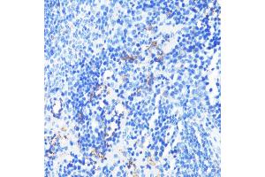 Immunohistochemistry of paraffin-embedded mouse spleen using CD11a/LFA-1A/ITGAL antibody (ABIN3015541, ABIN3015542, ABIN3015543, ABIN1680526 and ABIN6218728) at dilution of 1:100 (40x lens). (ITGAL antibody  (AA 26-306))