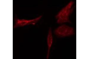 ABIN6274777 staining HT29 cells by IF/ICC. (RPL3 antibody  (C-Term))