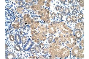 KEAP1 antibody was used for immunohistochemistry at a concentration of 4-8 ug/ml to stain Epithelial cells of renal tubule (arrows) in Human Kidney. (KEAP1 antibody  (C-Term))