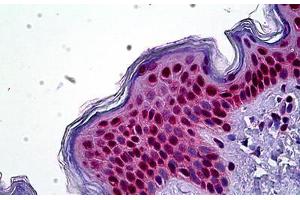 Human Skin: Formalin-Fixed, Paraffin-Embedded (FFPE) (SETD8 antibody  (N-Term))