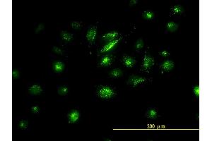 Immunofluorescence (IF) image for anti-FOS-Like Antigen 2 (FOSL2) (AA 1-122) antibody (ABIN560942)