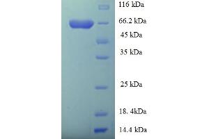 SDS-PAGE (SDS) image for GDP Dissociation Inhibitor 2 (GDI2) (AA 1-445), (full length) protein (His-SUMO Tag) (ABIN4975357)