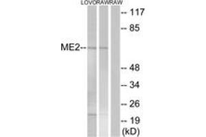 Western blot analysis of extracts from RAW264. (NAD-ME antibody  (AA 201-250))