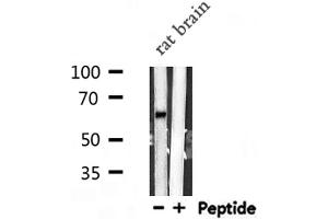 Western Blotting (WB) image for anti-VGF Nerve Growth Factor Inducible (VGF) (Internal Region) antibody (ABIN6257550)