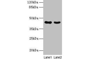 Western blot All lanes: MAS1L antibody at 2 μg/mL Lane 1: Colo320 whole cell lysate Lane 2: Hela whole cell lysate Secondary Goat polyclonal to rabbit IgG at 1/10000 dilution Predicted band size: 43 kDa Observed band size: 43 kDa (MAS1L antibody  (AA 318-378))