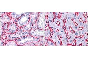 Anti collagen IV antibody (1:400, 45 min RT) showed strong staining in FFPE sections of human kidney (Left) with strong red staining observed in glomeruli and liver (Right) with strong staining in sinusoids. (Collagen IV antibody  (Biotin))